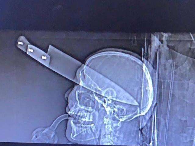 Homem que cravou faca em cr&acirc;nio de v&iacute;tima diz que foi amea&ccedil;ado