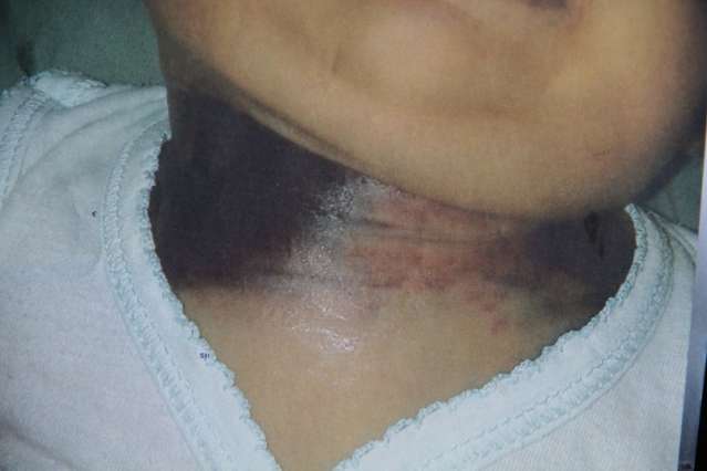 Pais pedem a exuma&ccedil;&atilde;o do corpo de beb&ecirc; ap&oacute;s morte no Hospital Regional