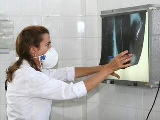 Profissional de saúde analisa raio-x de pulmão (Foto: Agecom Bahia/Agência Brasil/Divulgação)