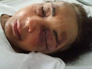 Idosa foi internada na Santa Casa com ferimentos na face e um corte profundo na panturrilha, diz neto (Foto: Arquivo Pessoal)