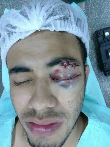 Jovem fica cego ap&oacute;s levar surra em sa&iacute;da de festa no Parque dos Poderes