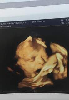 O rostinho de Sophia visto de um ultrassom. (Foto: Acervo Pessoal)