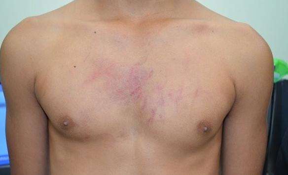 Adolescentes espancam menino de 13 anos e filmam tortura