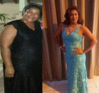 Ana Rachel, fez tratamento em 2014 eliminou 33kg mantêm até hoje - Foto Divulgação.