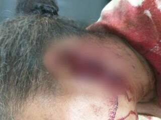 Vítima foi socorrida até o hospital da cidade com sangramento intenso (Foto: Rio Brilhante em Tempo Real)
