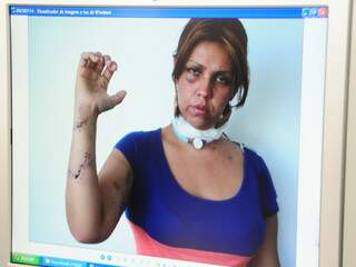 Após prestar depoimento à polícia, Michely mostra os ferimentos deixados pelo marido (Foto: Arquivo da polícia)