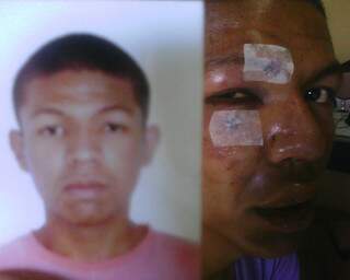 Jovem mostra foto ante e depois de agressão.