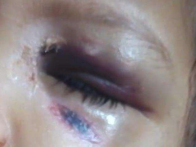 Justi&ccedil;a deve decidir o que fazer em rela&ccedil;&atilde;o a tios que agrediram crian&ccedil;as 