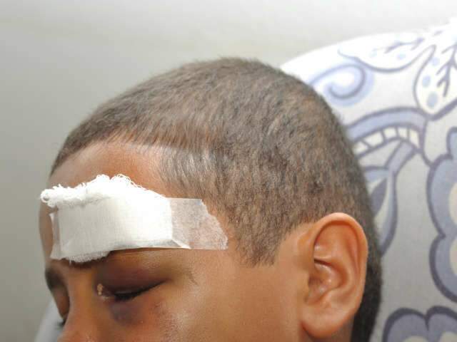  Adolescente suspeito de agredir garoto em escola ser&aacute; ouvido nesta quarta