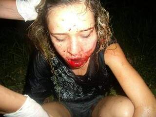 Ariany, aos 21 anos, quando foi agredida por Marcos: cortes nos lábios, língua e e hematomas no na boca e no olho (Foto/Reprodução: Facebook)