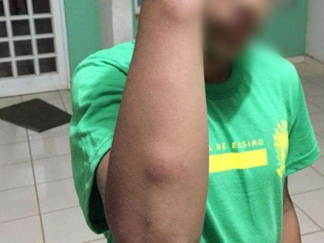 Conselho Tutelar recolhe menino que apanhou da m&atilde;e com cabo de rodo