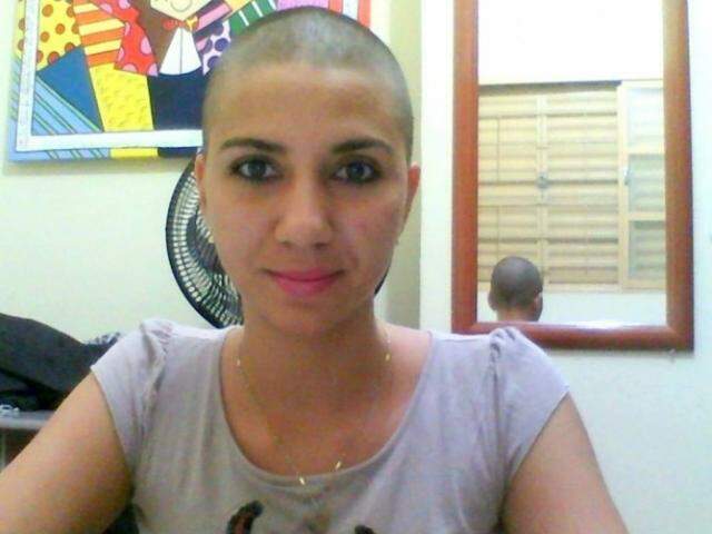 Me arrependi por ficar careca? 