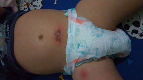 Pela segunda vez, mãe aciona polícia após filha voltar ferida de Ceinf