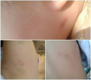 Menina tinha marca de agressões pelo corpo (Foto: Coxim Agora)