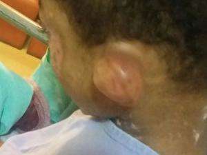V&iacute;tima de socos e queimaduras, menino segue internado em hospital 