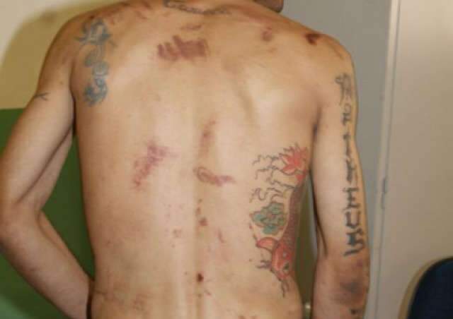  OAB/MS constata agress&atilde;o a preso e Agepen abre sindic&acirc;ncia