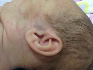 Lesões ocorreram até no rosto da criança que tem pouco mais de 40 dias de vida. (Foto: Direto das Ruas)