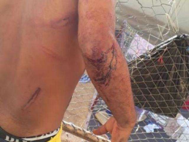Presos feridos em confronto com o Choque passar&atilde;o por corpo de delito 
