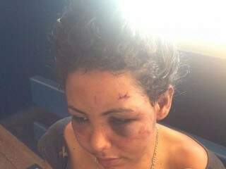 Jovem é agredida com garrafada, socos e mordidas, desmaia e acorda em canavial Jovem é agredida com garrafada, socos e mordidas, desmaia e acorda em canavial