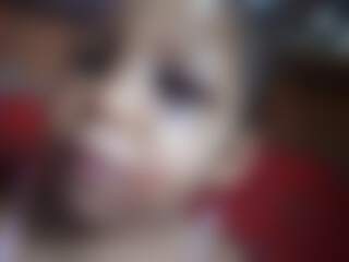 Criança tem machucado no olho e na boca; foto desfocada para não identificar a vítima, conforme prevê o ECA (Estatuto da Criança e do Adolescente) (Foto: Direto das Ruas)