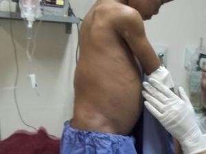 Menino que era torturado passa por cirurgia e brinca com livros