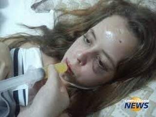 Giovanna teve rosto quebrado em diversas partes por causa das agressões do ex-namorado (Foto: Arquivo)