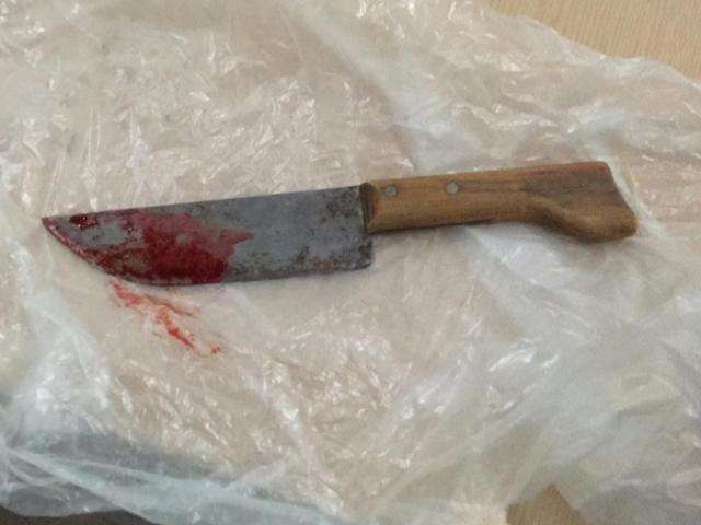 Jovem de 21 anos morre ap&oacute;s ser esfaqueado por ex-namorada 