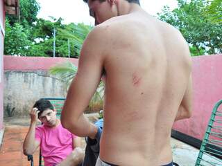 Juliano disse que foi agredido nas costas e pode ter fraturado a costela. (Fotos: João Garrigó)