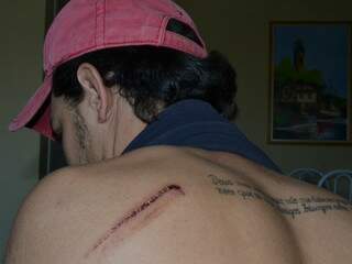 Bruno sofreu lesões por conta de briga em bar. (Foto: Minamar Júnior)