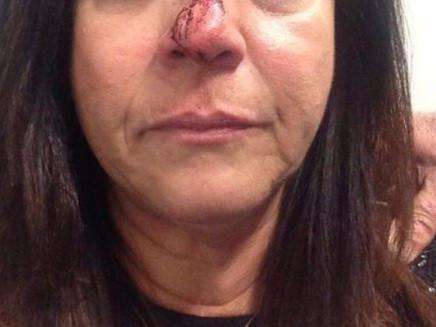 Pol&iacute;cia identifica suspeito de ferir mulher com lata de cerveja no tr&acirc;nsito