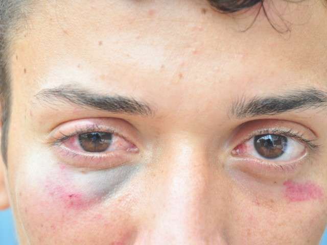 Fam&iacute;lia acusa Pol&iacute;cia de agress&atilde;o; caso &eacute; registrado como desacato