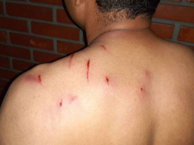 Trio rende e esfaqueia taxista, funde motor do carro e acaba preso