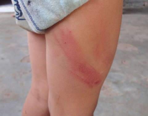  Pai &eacute; detido ap&oacute;s agredir filho de tr&ecirc;s anos com chicote em Alcin&oacute;polis