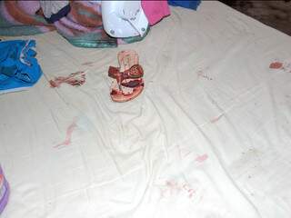 Sandália que um das vítimas calçava ficou sujo de sangue