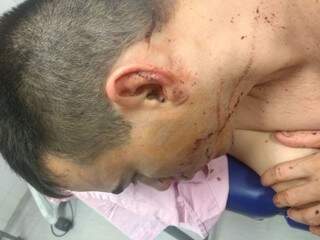 Guarda foi ferido durante abordagem na Praça dos Imigrantes. (Foto: Direto das Ruas)