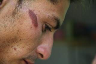 Rafael Corrêa de Souza, 22, afirma que foi agredido por policiais e guardas. (Foto: Marcos Ermínio)