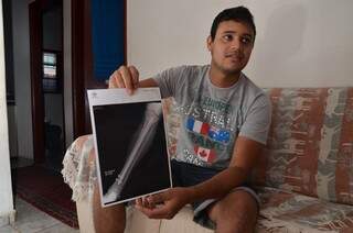 Por conta do acidente, Lúcio está com três pinos na perna (Foto: Vanderlei Aparecido)