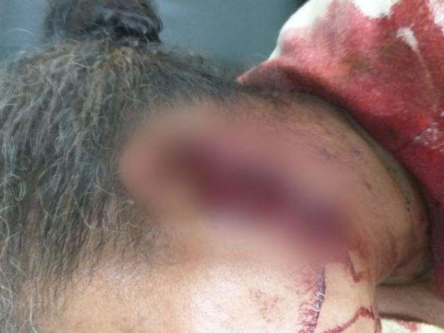 Marido &eacute; preso ap&oacute;s cortar orelha de mulher com fac&atilde;o 