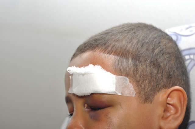 Garoto apanha durante aula em escola e chega a levar pontos no rosto