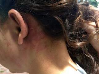 Vítima foi violentamente agredida, principalmente no rosto (Foto: Divulgação)