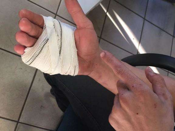 Churrasqueiro reage a assalto, tem m&atilde;o cortada e fere suspeito com canivete