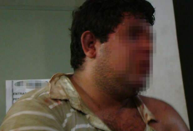  Policial leva mordida ao tentar conter homem embriagado, em Tr&ecirc;s Lagoas