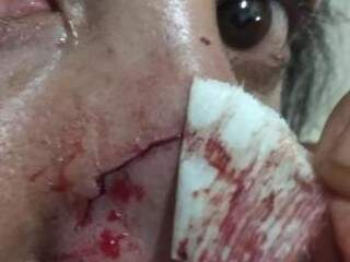 Mulher tem cabelo arrancado e &eacute; atropelada pelo marido em discuss&atilde;o