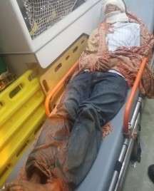 Homem &eacute; atacado por b&uacute;falo e tem ferimentos no rosto e na cabe&ccedil;a