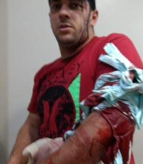Morador levou golpe de foice no braço e está internado (Foto: Direto das Ruas)