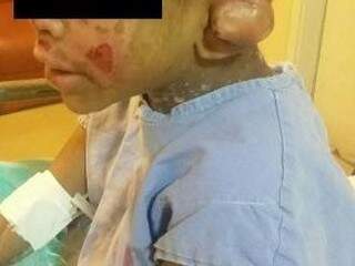 Criança deu entrada no hospital apresentando múltiplos ferimentos (Foto: Direto das ruas) 