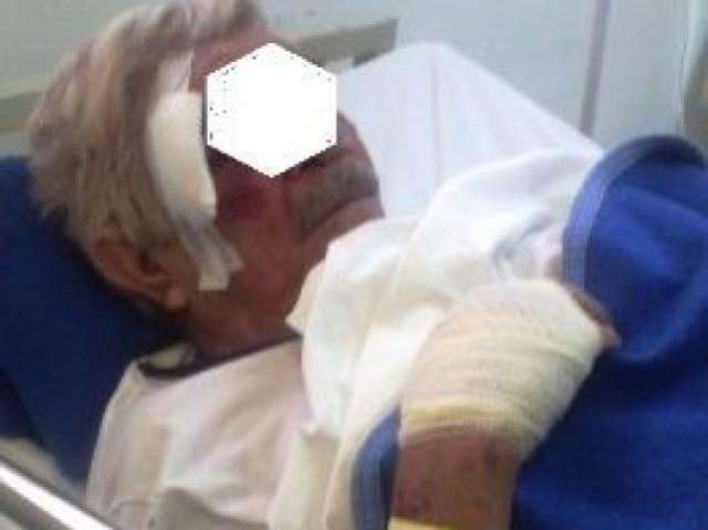 Idoso de 73 anos &eacute; agredido a pauladas por PM e outra duas pessoas  