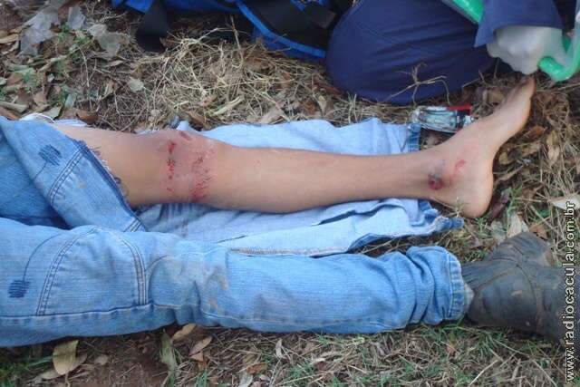  Caminh&atilde;o passa em cima de perna de adolescente