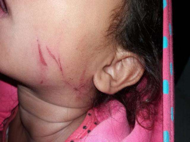 Descontrolada, m&atilde;e &eacute; presa por puxar cabelo e agredir a filha de 4 anos