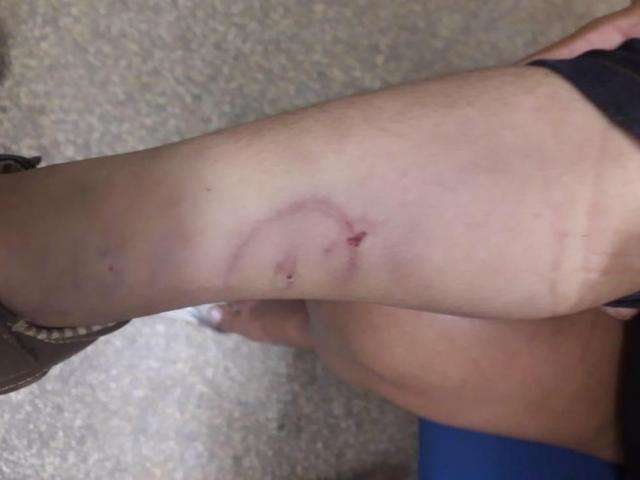 Crian&ccedil;a de 3 anos foi torturada pelo padrasto por fazer xixi na cama